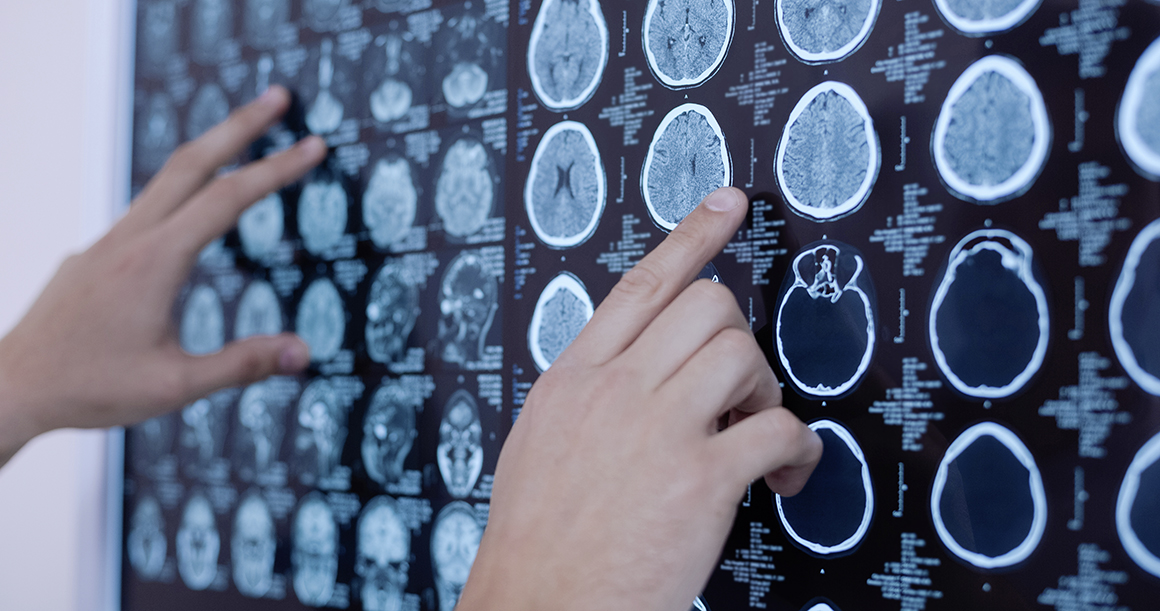 BZPG gründet eine MTR-Schule